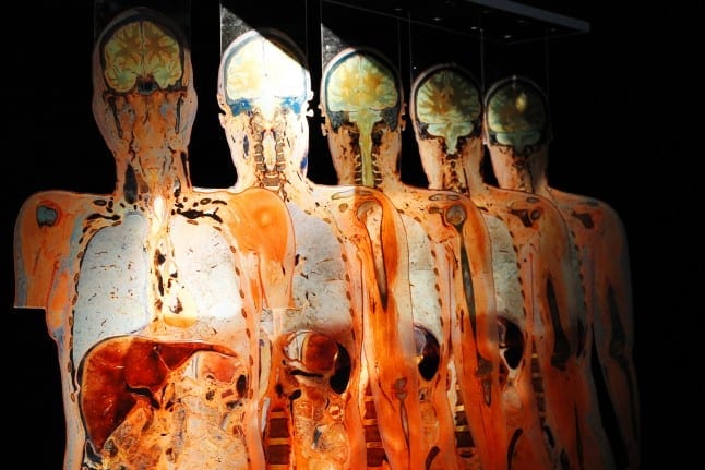Body Slices at Body Worlds Rx